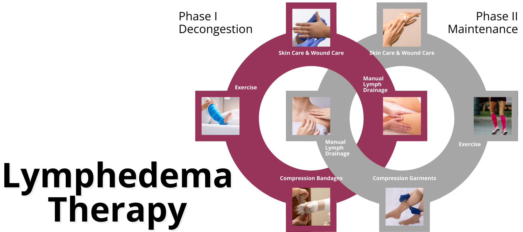 Lymphedema Education